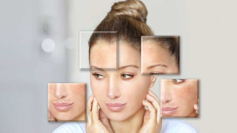 How to Reduce Melanin in Skin: Simple Tips for Even Skin Tone